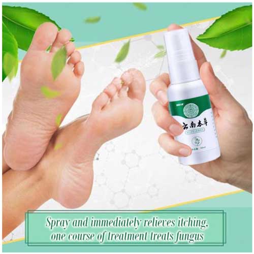 SuperLife Athlete’s foot treatment herbal antibacterial spray My Basket